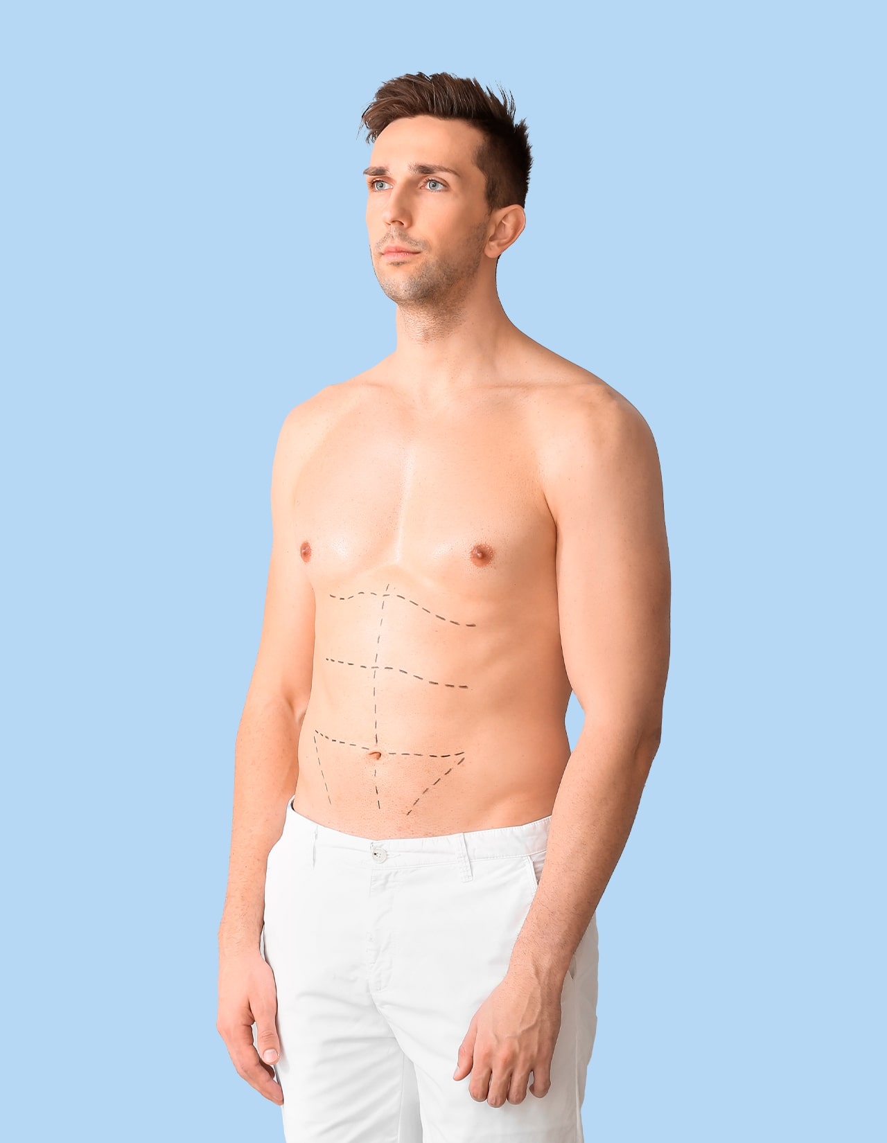 Common Requested Liposuction Treatment Areas